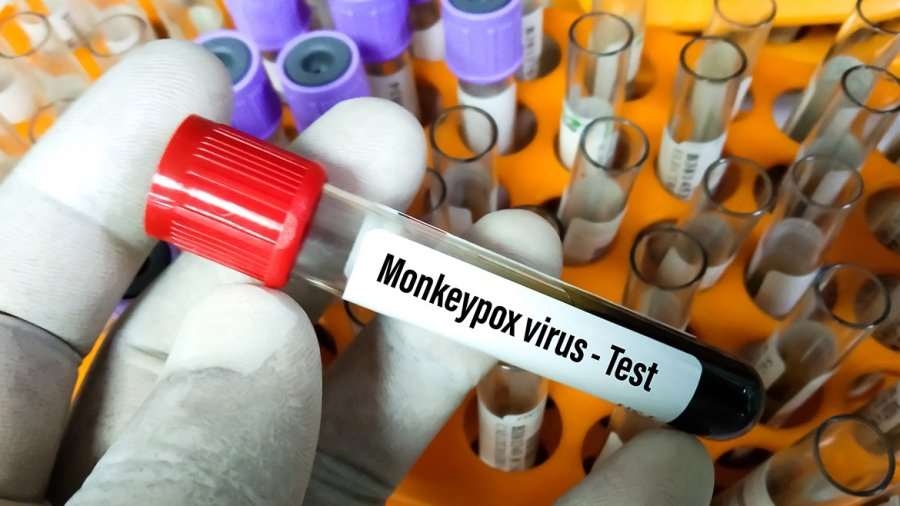 Sedes aguarda el diagnóstico de Cenetrop sobre dos casos sospechosos de viruela del mono